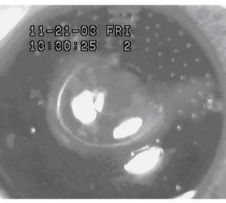 Image: Redistribution of strain and curvature in the porcine anterior lens capsule following a continuous circular capsulorhexis
