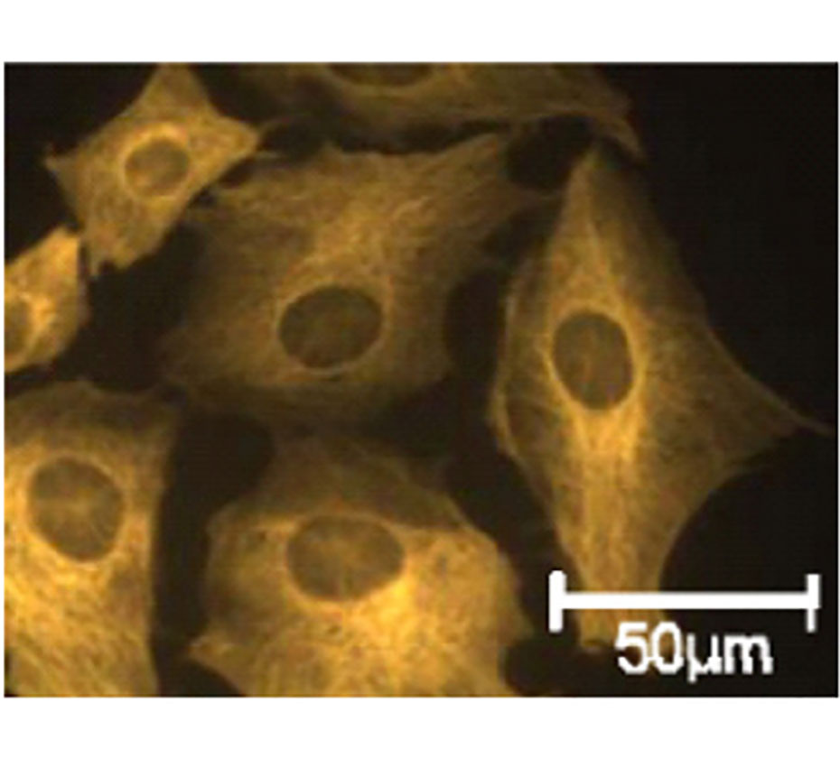 Image: In vitro models for glaucoma research: Effects of hydrostatic pressure