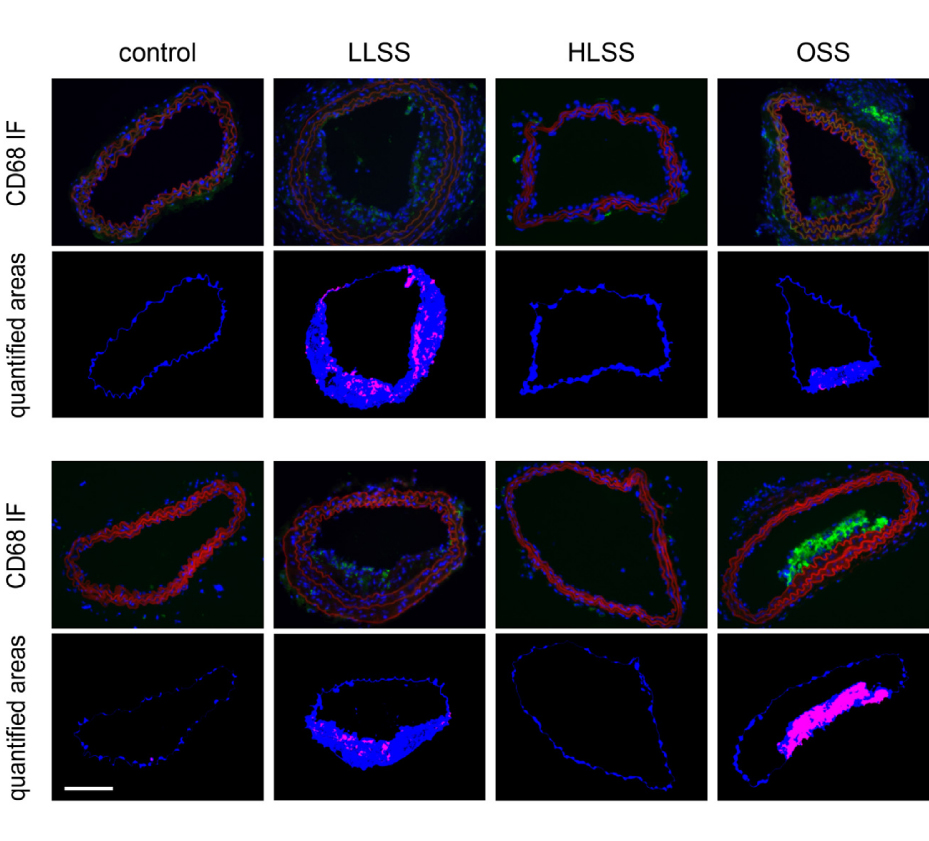 Image: Shear stress-induced atherosclerotic plaque composition in ApoE-/- mice is modulated by connexin37
