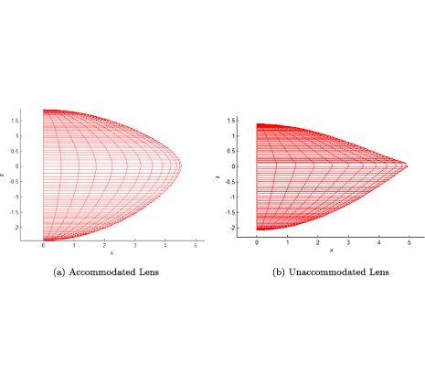 Image: Accommodation of the human lens capsule using a finite element model based on nonlinear regionally anisotropic biomembranes