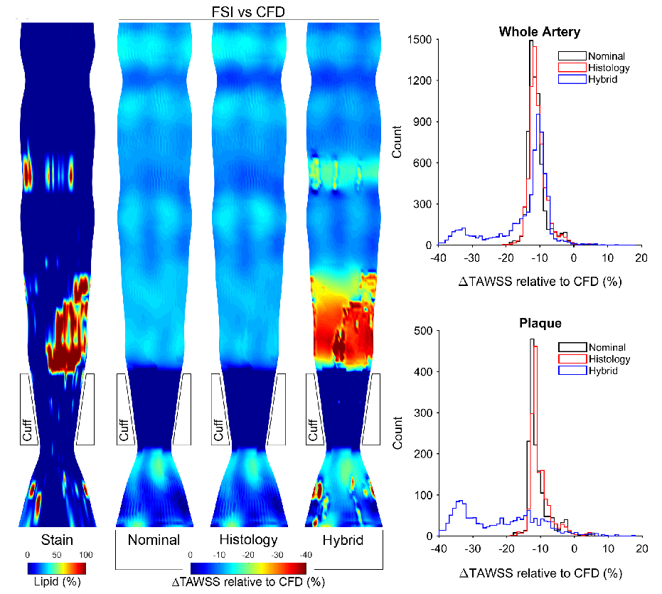 Image: Considerations for analysis of endothelial shear stress and strain in FSI models of atherosclerosis