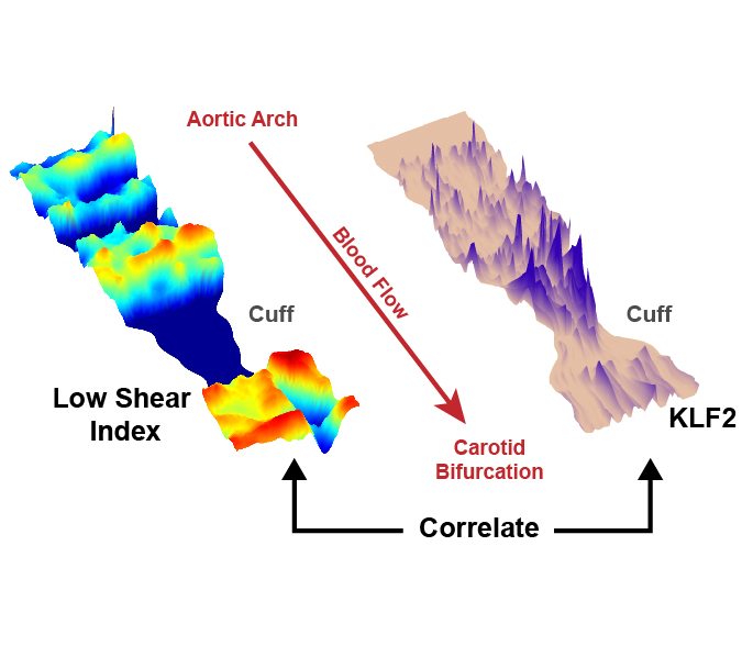 Mouse carotid artery from micro-CT imaging, instrumented with a cuff that disturbs blood flow and promotes the development of advanced plaques. Vessels are computationally opened and layed flat to look at the distribution of shear and endothelial signaling (KLF2).